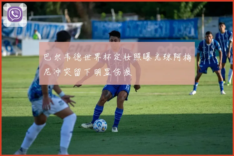巴尔韦德世界杯定妆照曝光琼阿梅尼冲突留下明显伤痕